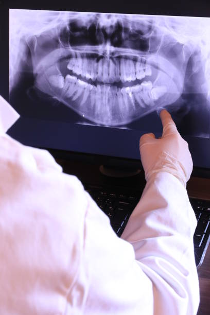 Best Teeth Whitening  in Houma, LA